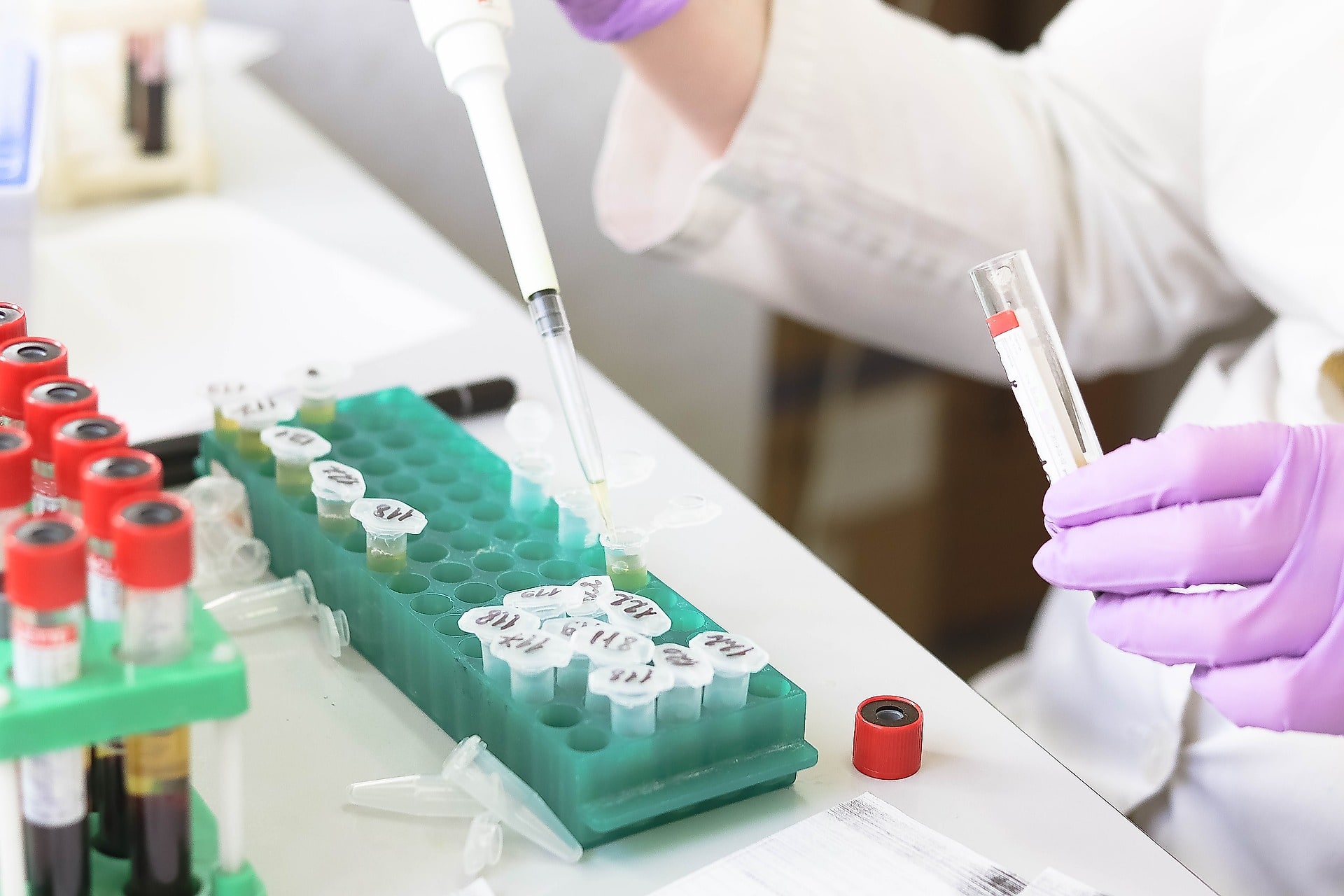 Il banco prelievi del laboratorio di analisi