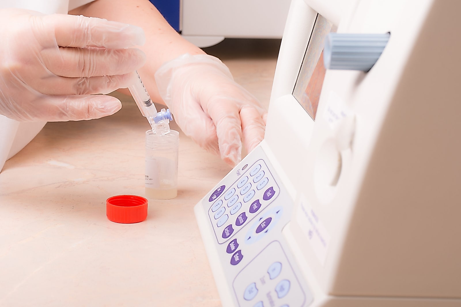 La strumentazione del laboratorio di analisi